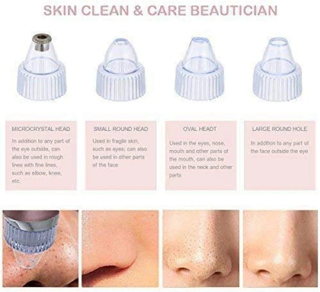 Blackhead Remover Tool 💆‍♀ ALSOUQMART